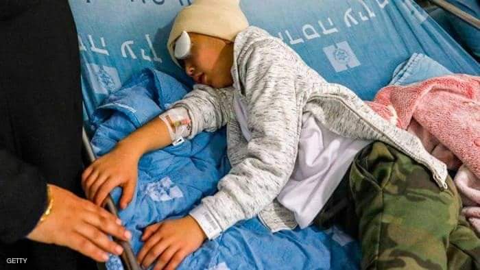 الطفل مالك عيسى يرقد على سرير العلاج بعد فقد عينة