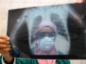 توقعات رسمية بزيادة إصابات كورونا في مصر مجددا