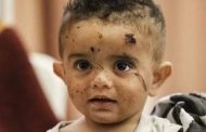 طفل فلسطيني أصيب خلال القصف الإسرائيلي على غزة.