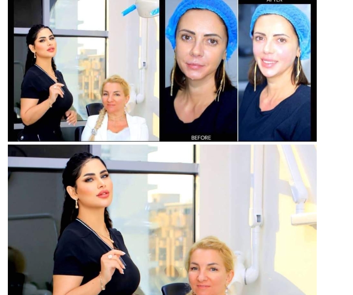 الدكتورة إسراء رسول تكشف حقائق عمليات تجميل الوجه الزائدة وفوائد الفيلر والبوتوكس