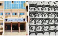 فريق طبي بمستشفىات قنا الجامعية ينجح في العلاج الجراحي والدوائي لمريض الانبعاث القيحي (Calcification encysted Empyema)