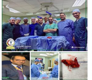 مستشفيات قنا الجامعية تواصل التميز باجراء 25 عملية استئصال جزئي للكلية بالمنظار بنجاح