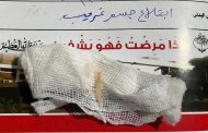 تدخلات فجرية حاسمة بقنا العام تنقذ سيدة من شوكة سمكة وطفل من جسم غريب بالأنف