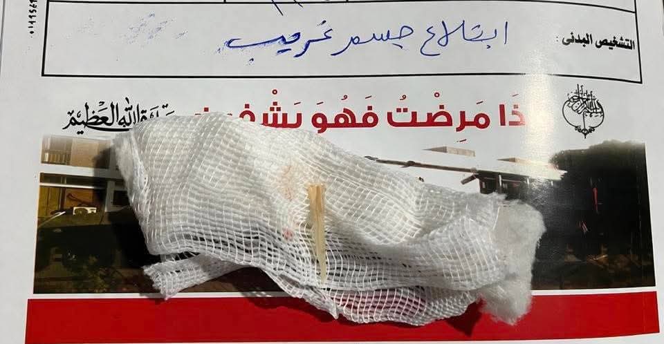تدخلات فجرية حاسمة بقنا العام تنقذ سيدة من شوكة سمكة وطفل من جسم غريب بالأنف